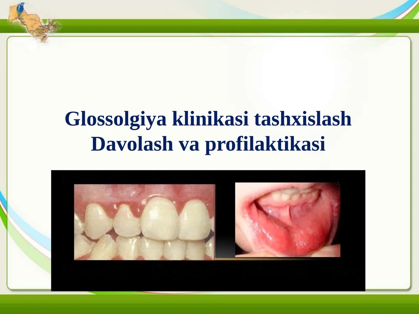 Glossalgiya tashxislash klinikasi.Davolash metodikasi. 1