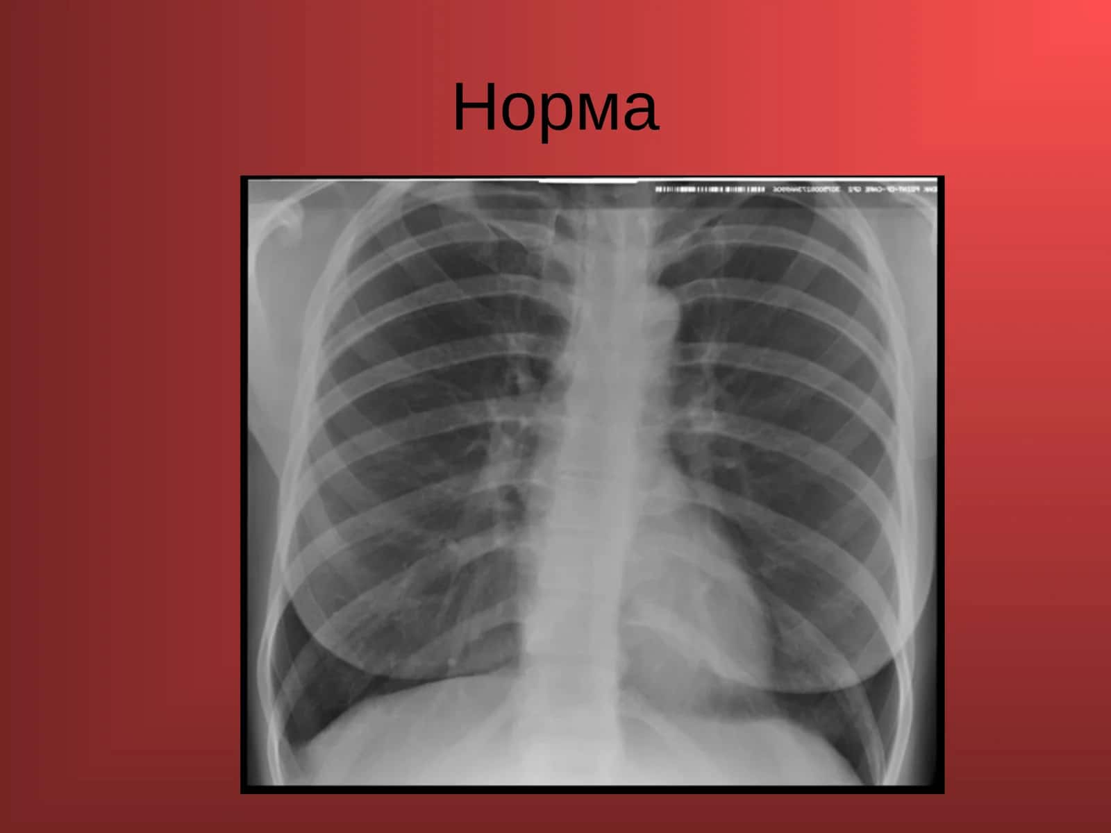 Норма 1