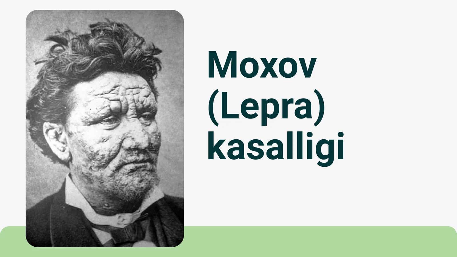 Mohov Lepra kasalligi 1