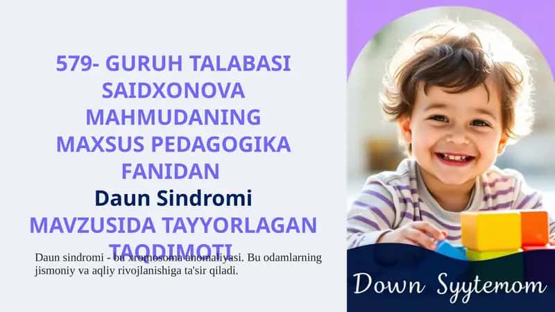 DaunSindromi 1