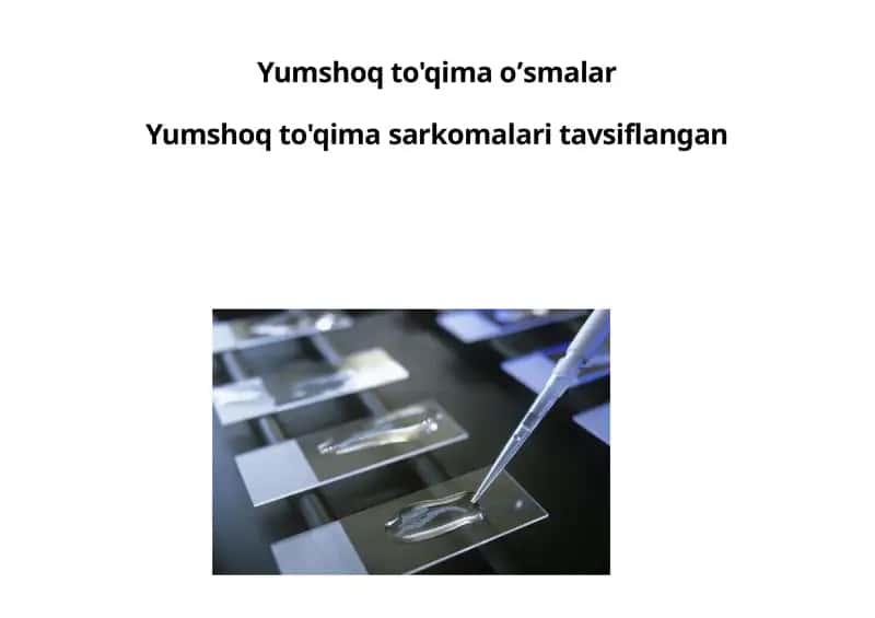 Yumshoq to'qimalar sarkomlari 1