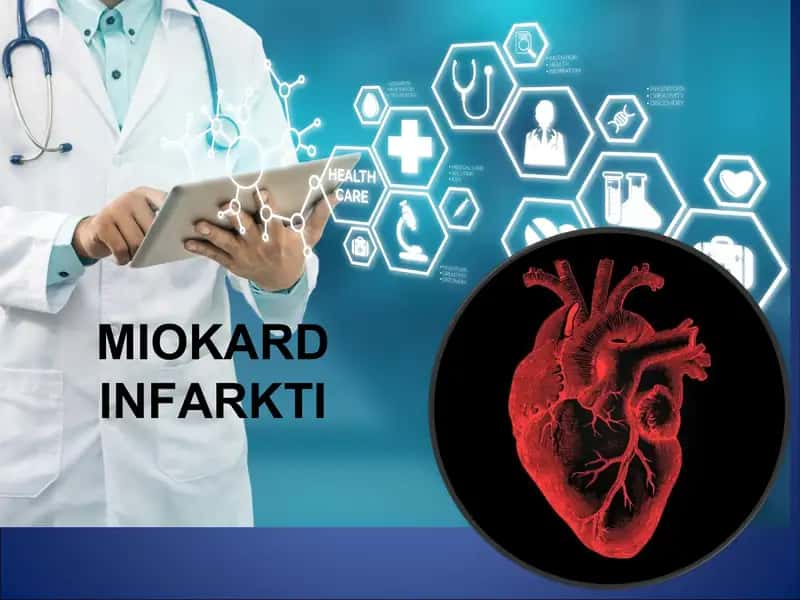 MIOKARD INFARKTI 1