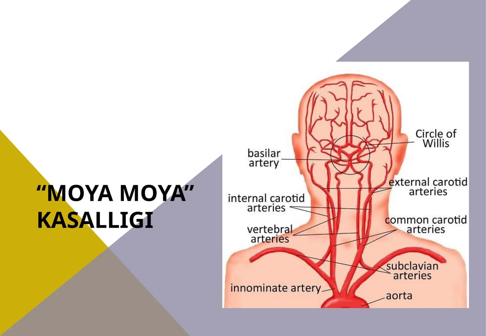 Moya moya kasalligi 1