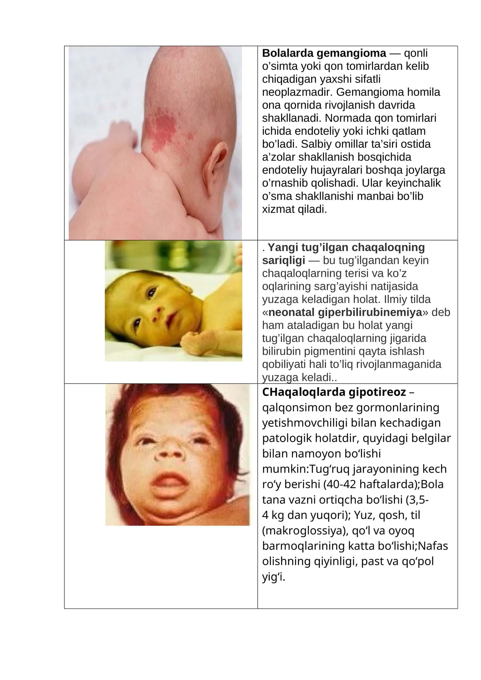 Neonatal Giperbilirubinemiya 1