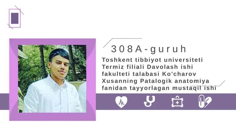 Mavzu:Uveit. Katarakta. Retinopatiyalar. To'r parda o'smalari. Ko'ruv nerv patologiyaları. 1