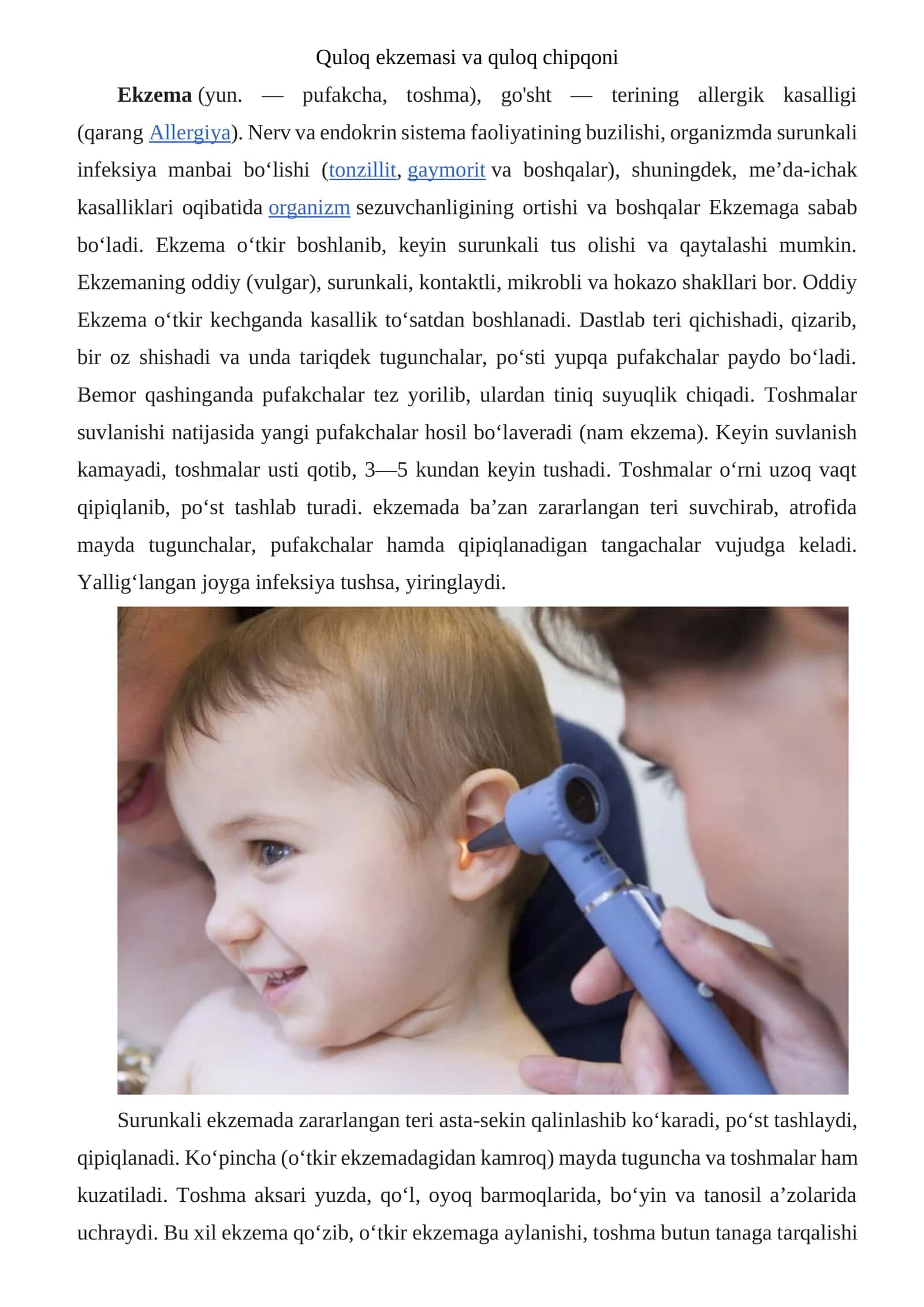 Quloq ekzemasi va quloq chipqoni 1