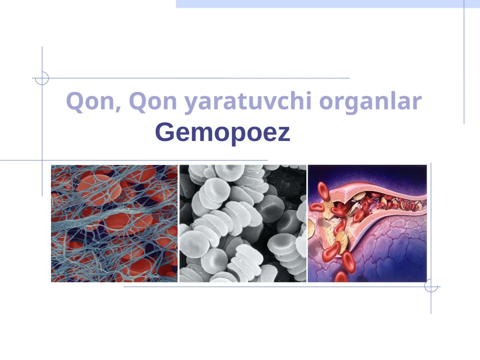 Gemopoez 1