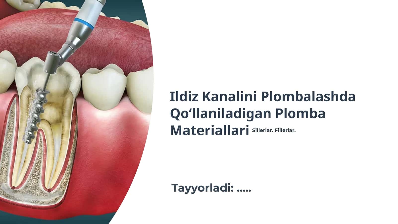 Ildiz Kanalini Plombalashda Qo‘llaniladigan Plomba Materiallari 1