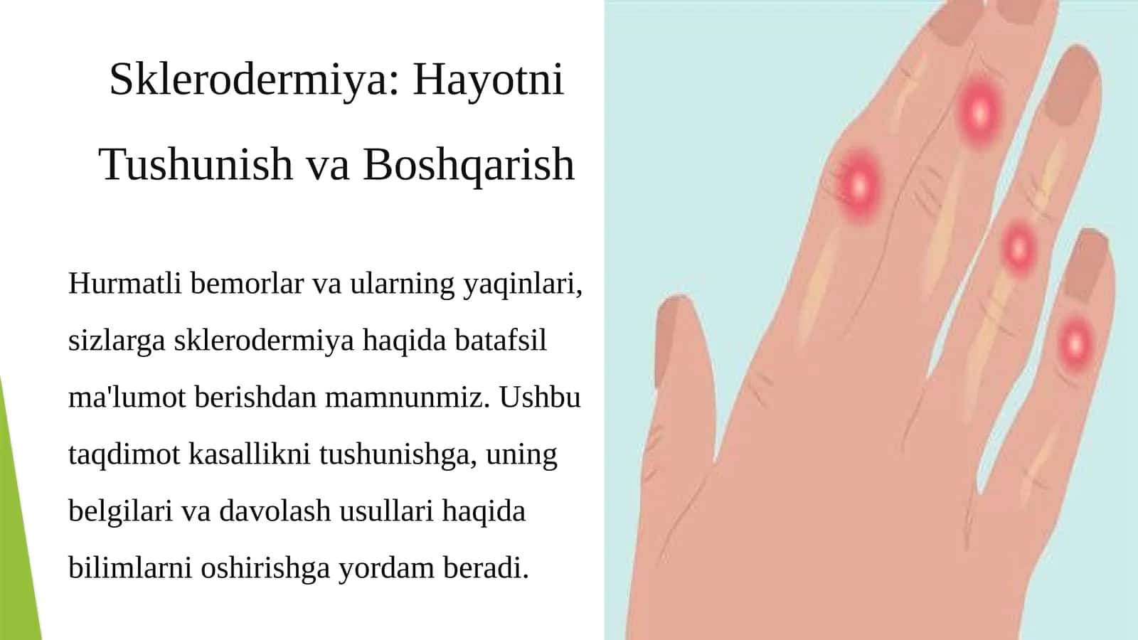 Sklerodermiya: Hayotni Tushunish va Boshqarish 1