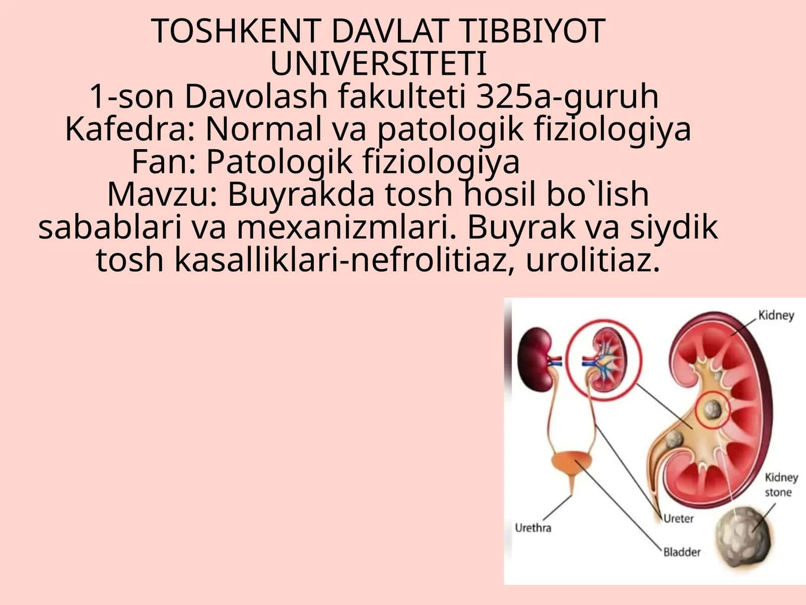 Buyrak tosh kasalligi hosil boʻlishi sabablari, klinikasi, davolash usullari 1