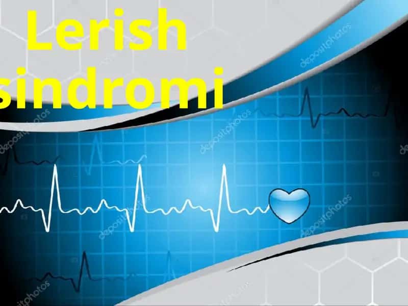 Lerish sindromi yurak 1