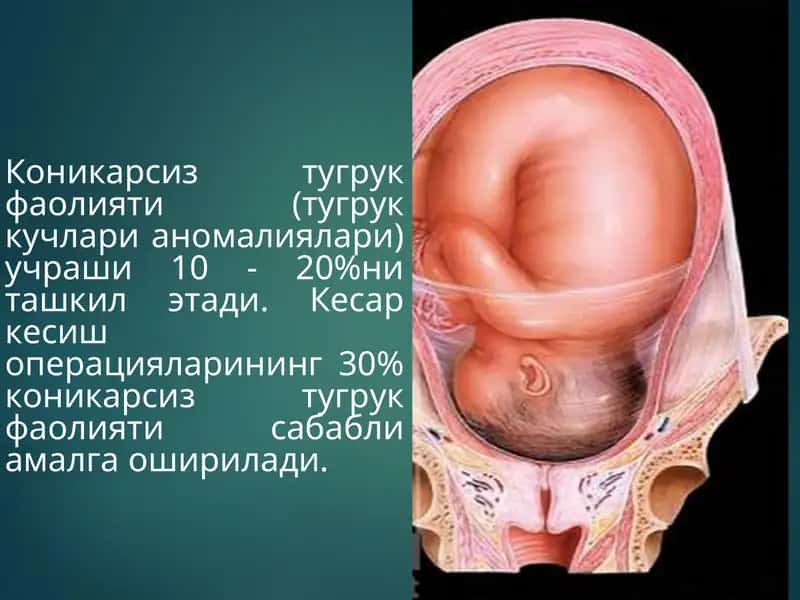 Коникарсиз туғруқ фаолияти 1
