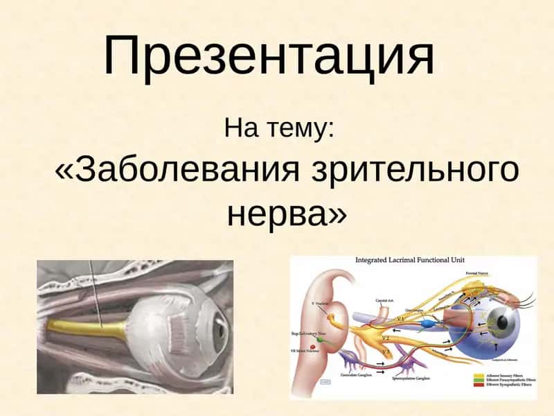 Заболевания зрительного нерва 1