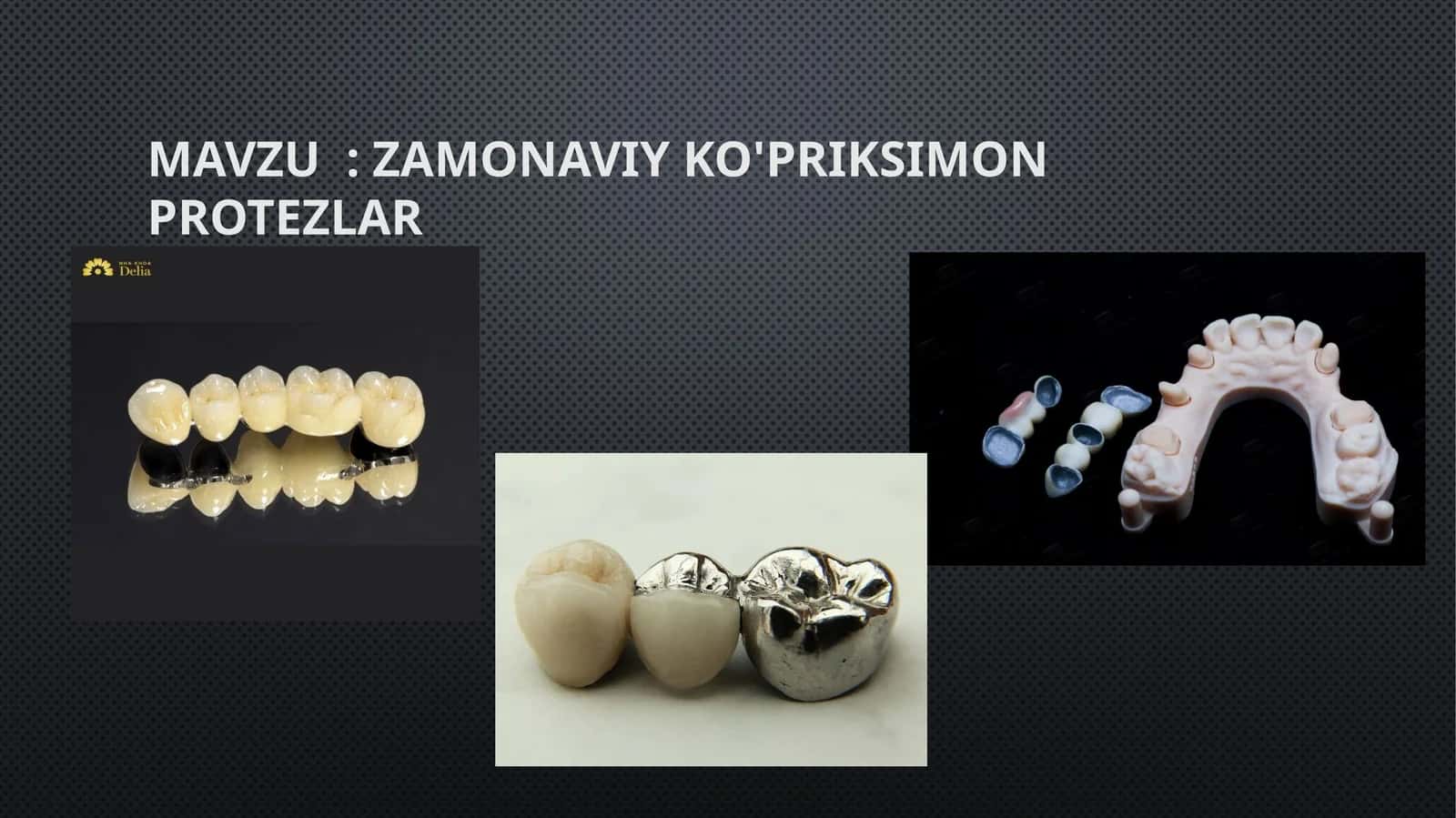 Zamonaviy Ko'priksimon protezlar 1