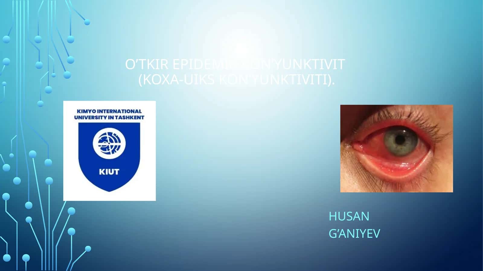 O’tkir epidemik kon’yunktivit(Koxa-Uiks kon’yunktiviti) 1