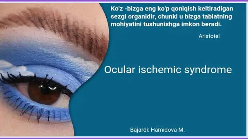 Og'ir ipsilateral yoki ikki tomonlama uyqu arteriyasi stenozi 1