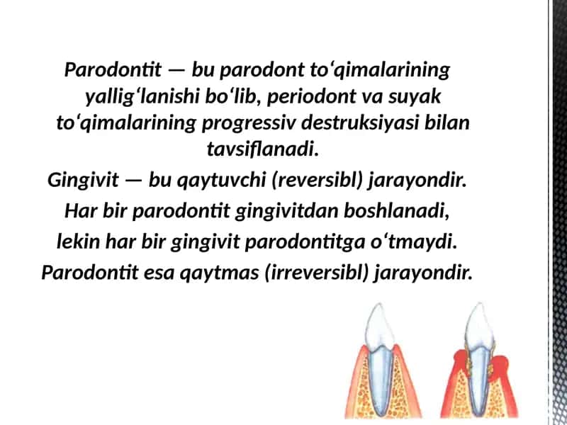 Parodontitlar . Yengil shakli va Gingivit qiyosiy tashxisi 1