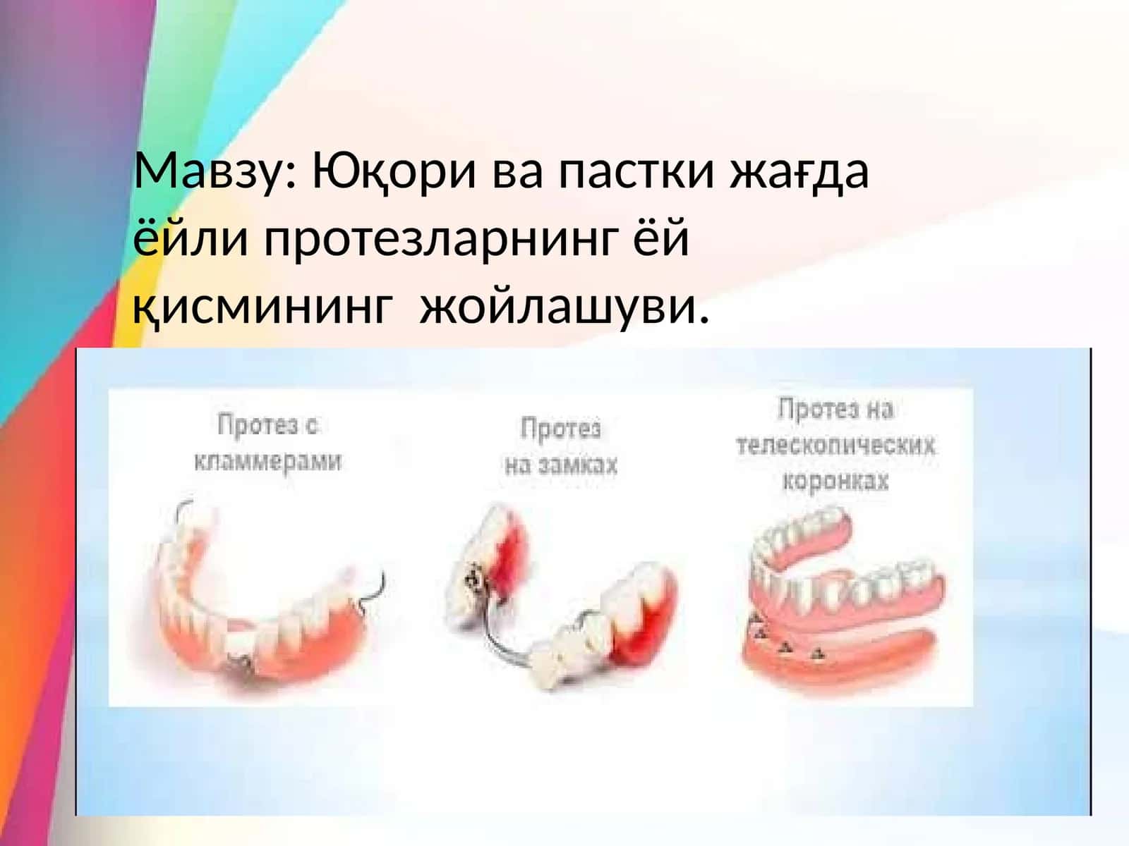 Ёйли протезларнинг ёй қисмий жойлашуви 1