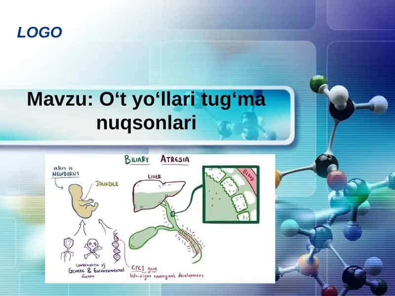 O‘t yo‘llari tug‘ma nuqsonlari 1
