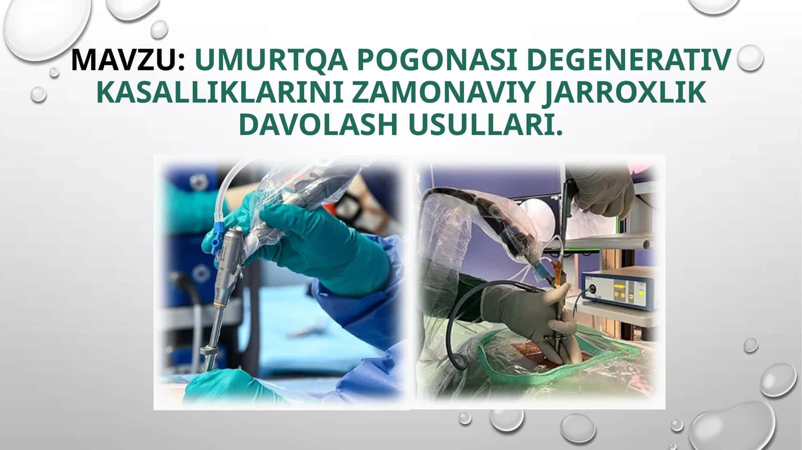 Umurtqapogonasidegenerativkasalliklarini zamonaviyjarroxlikdavolash usullari 1