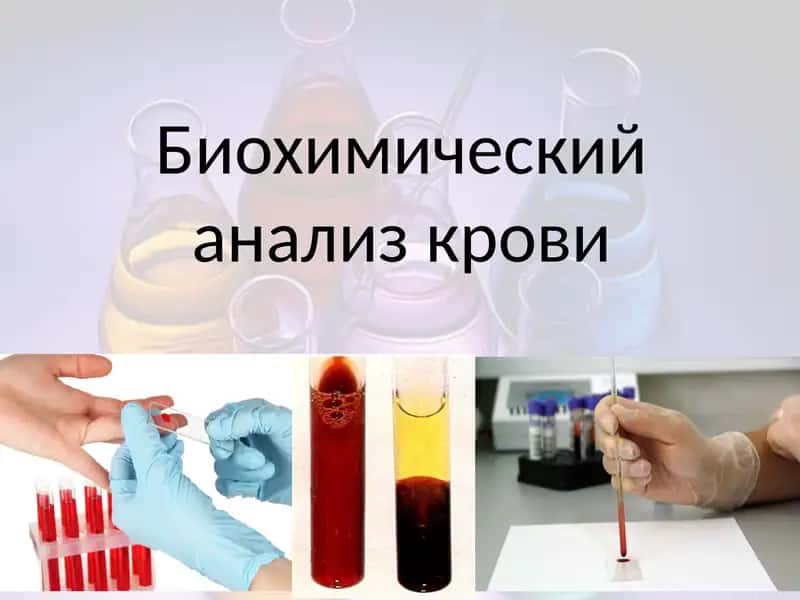 Биохимический анализ крови 1