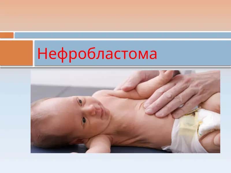 Нефробластома 1