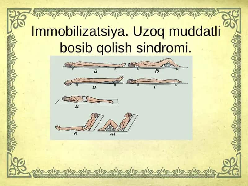 Immobilizatsiya.Uzoq muddatli bosib qolish sindromi 1
