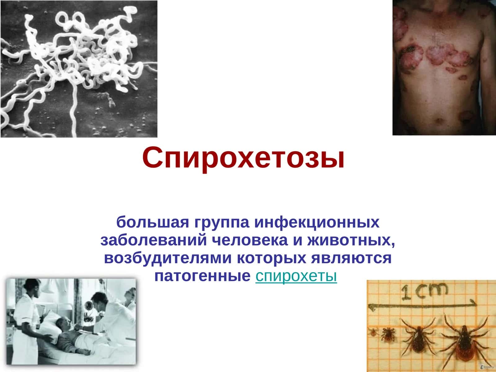 Спирохетозы 1