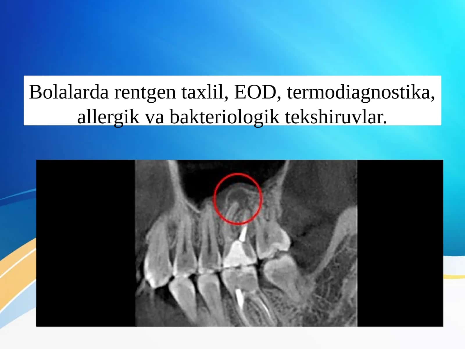 Bolalarda rentgen taxlil, EOD, termodiagnostika, allergik va bakteriologik tekshiruvlar. 1