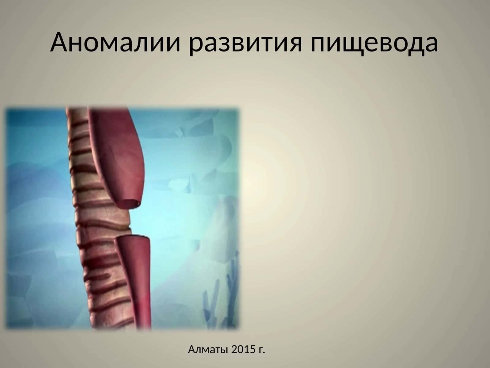 Аномалии развития пищевода 1