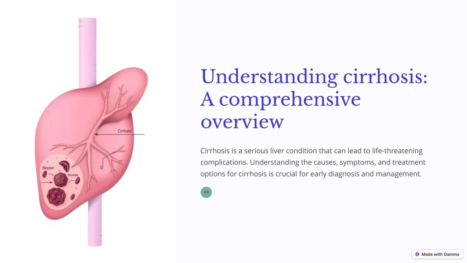Understanding cirrhosis: A comprehensive overview 1