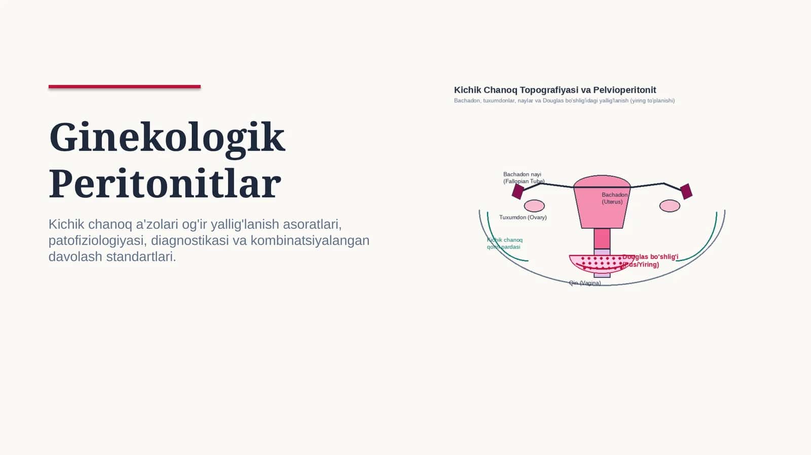 Ginekologik peritonitlar — 15 slaydli professional tibbiy taqdimot | Ginekologiya va akusherlik 1