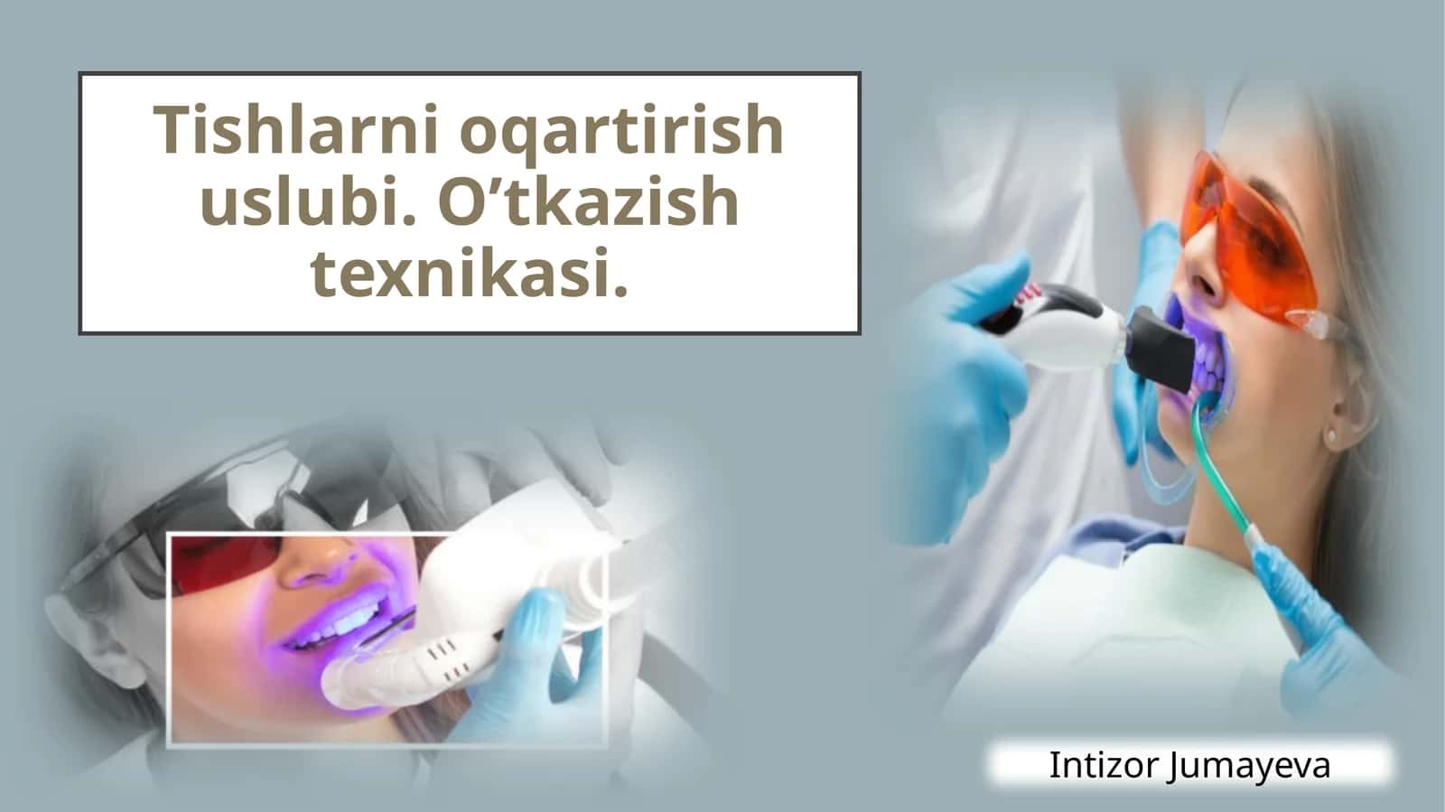 Tishlarni oqartirish usullari 1