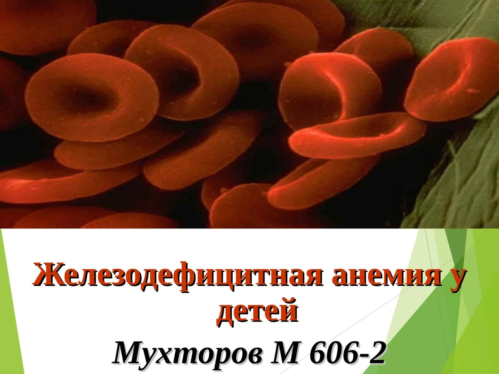 Железодефицитная анемия у детей 1