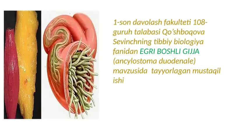 Egri Boshli Gijja 1