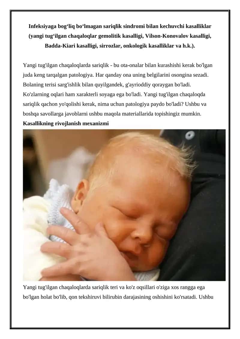 Yangi tug‘ilgan chaqaloqlarda sariqlik 1