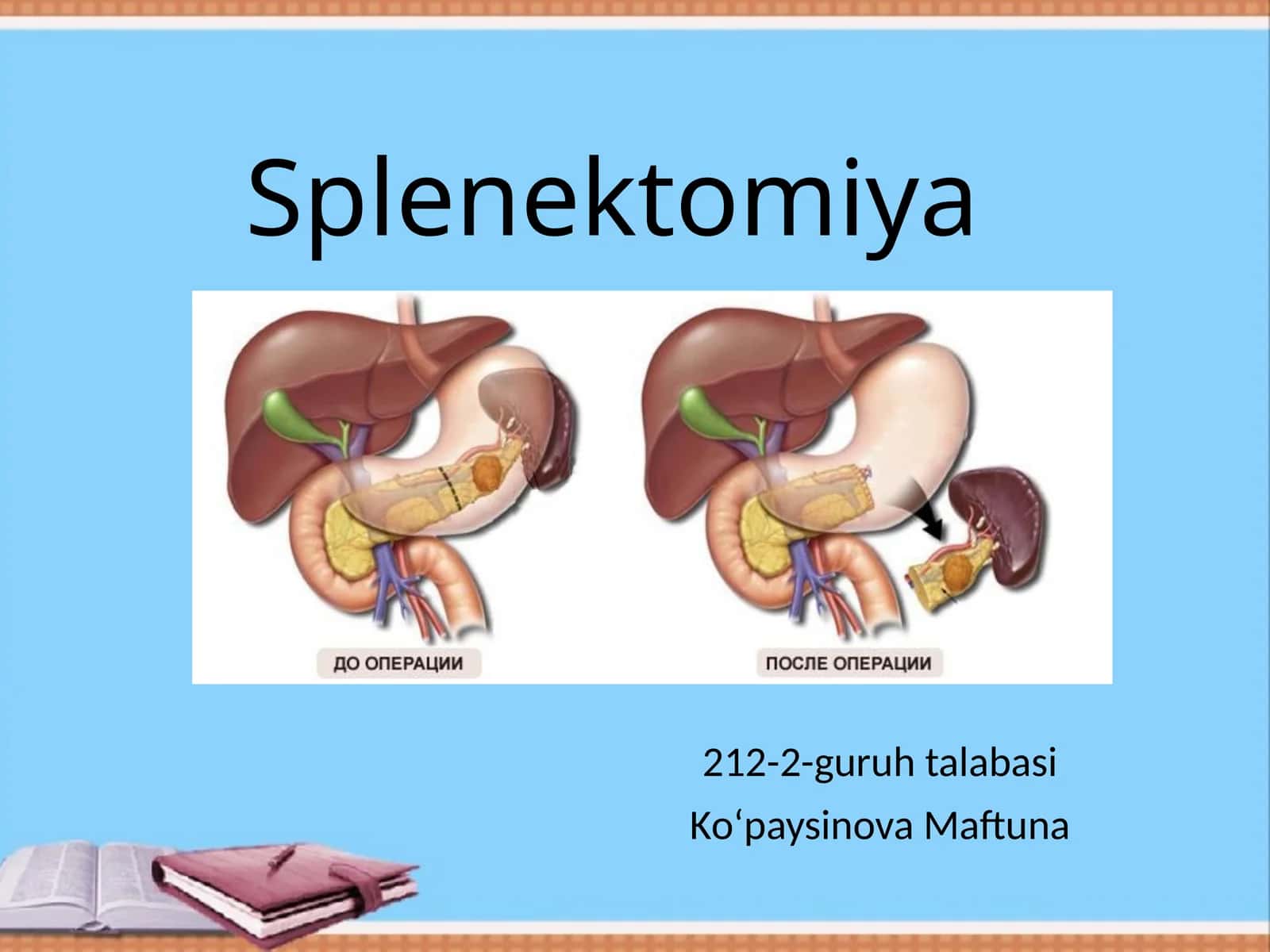 Splenektomiya 1