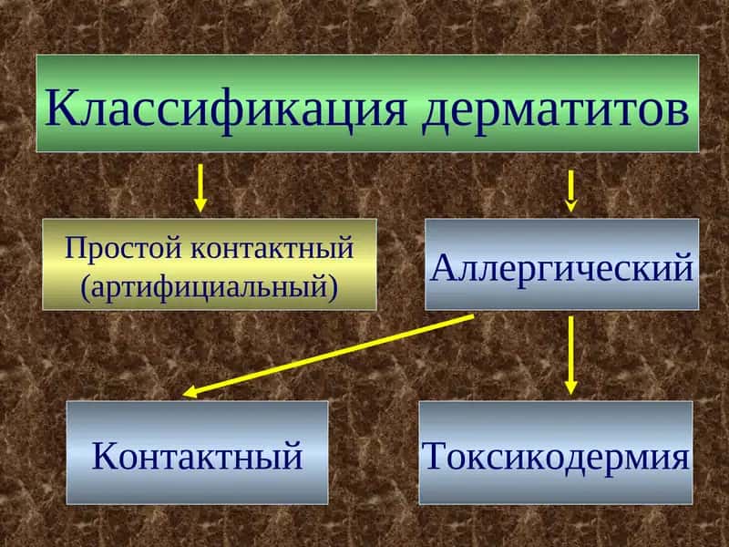 Классификация дерматитов 1