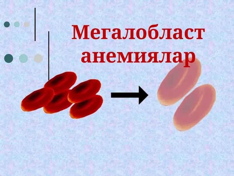 Мегалобласт  анемиялар 1