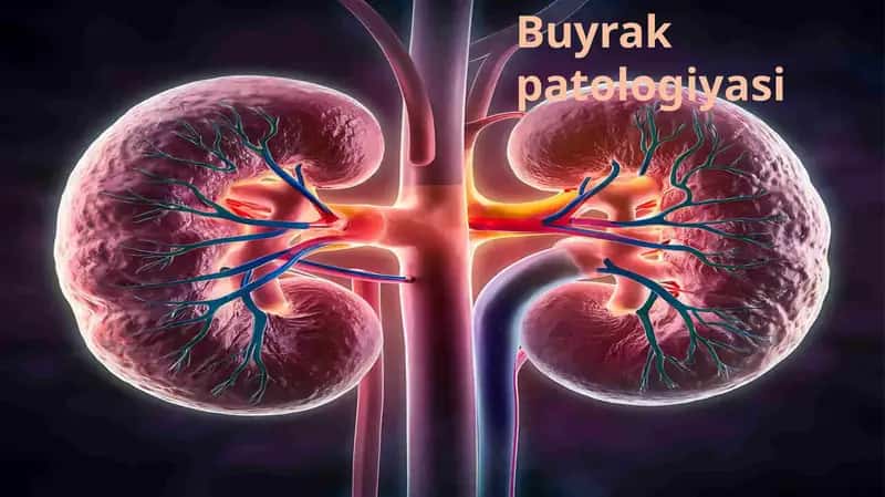 buyrak patalogiyasi 1