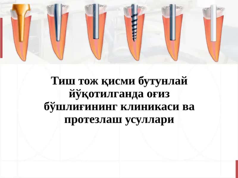 Тиш тож қисми бутунлай йўқотилганда оғиз бўшлиғининг клиникаси ва протезлаш усуллари 1
