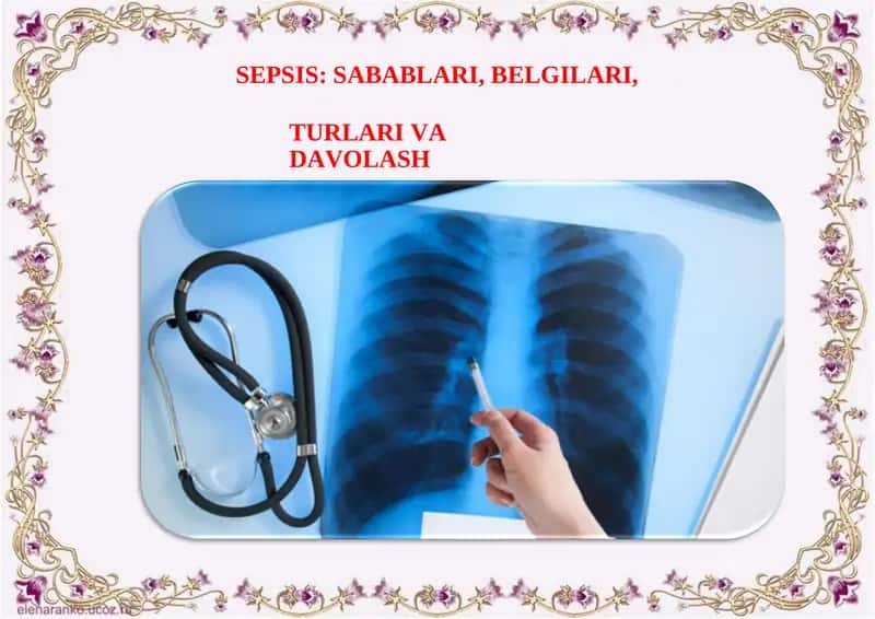 Sepsis: sabablari, belgilari, turlari va davolash 1