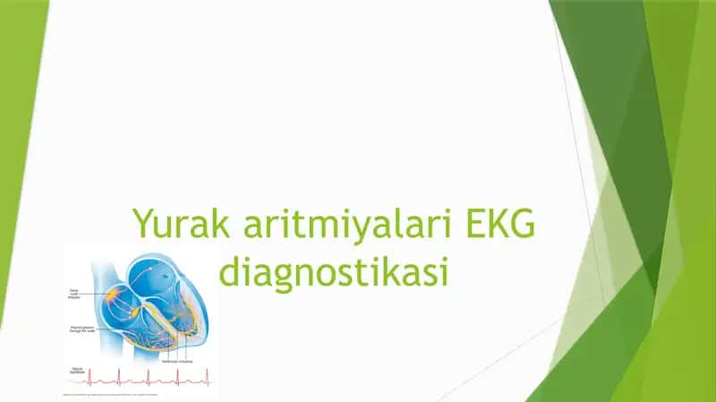 Yurak aritmiyalari EKG diagnostikasi 1
