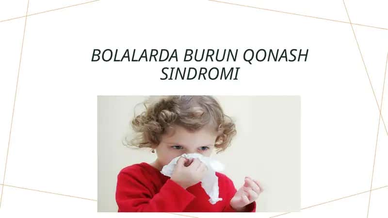 Bolalarda burun qonash sindromi 1