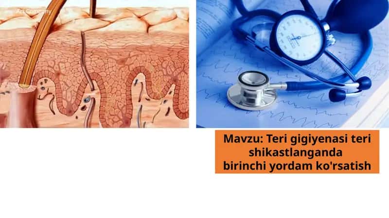 Terigigiyenasiterishikastlanganda birinchi yordam ko'rsatish 1