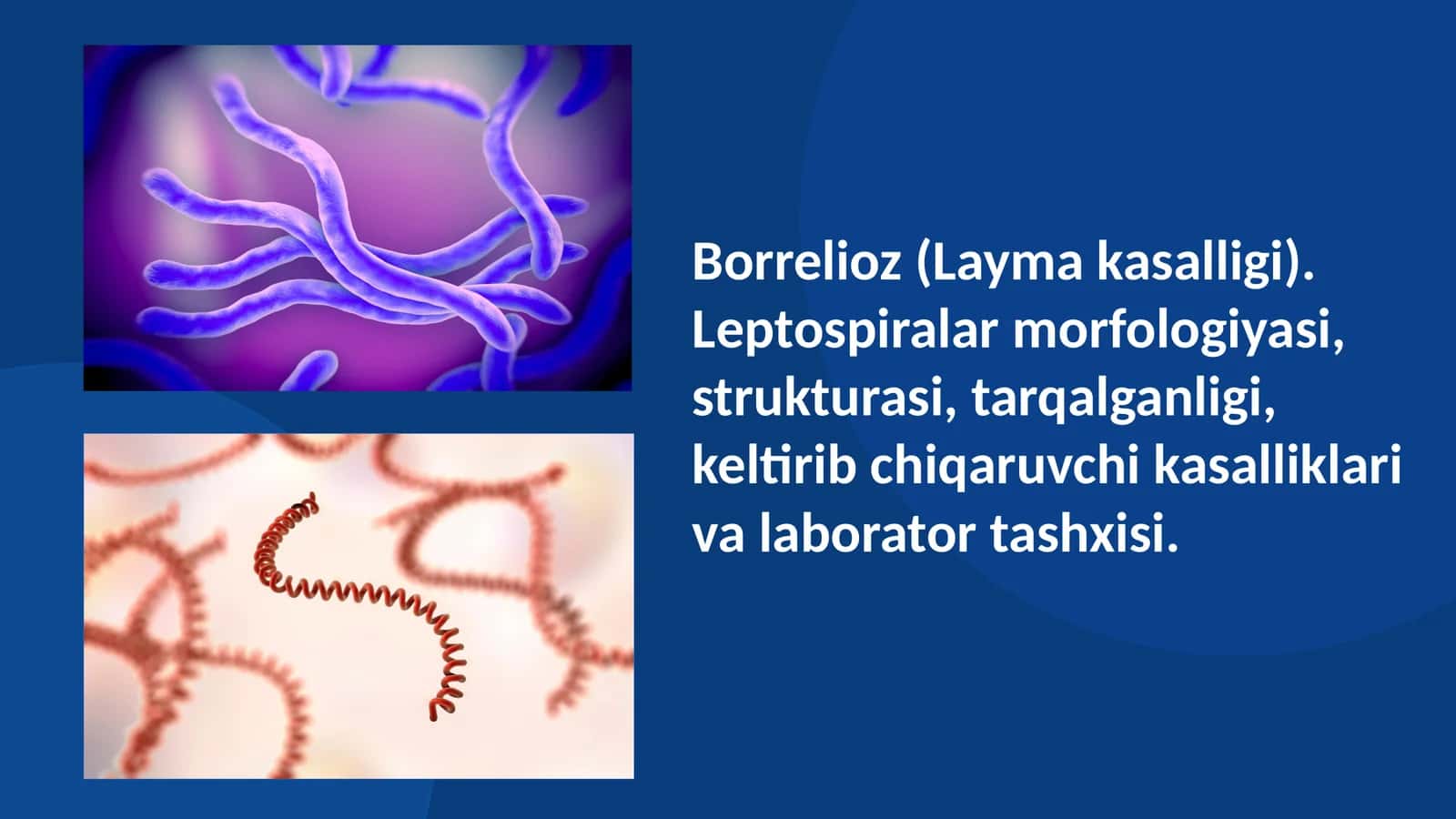 Borrelioz (Layma kasalligi). Leptospiralar morfologiyasi, strukturasi, tarqalganligi, keltirib chiqaruvchi kasalliklari va laborator tashxisi 1