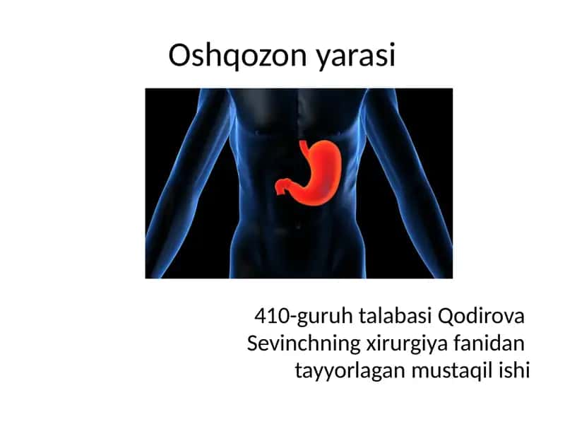 Oshqozon yarasi 1
