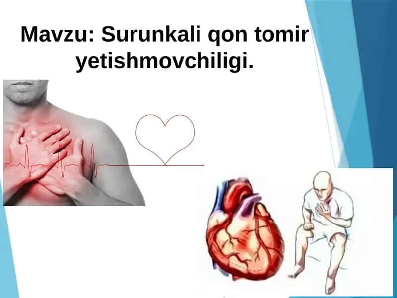 Surunkaliqontomiryetishmovchiligi 1