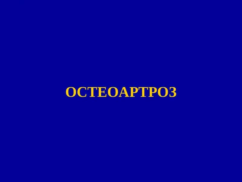 Остеоартроз 1