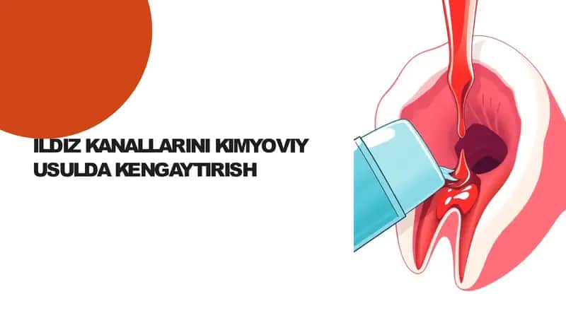 ILDIZ KANALLARINI KIMYOVIY USULDA KENGAYTIRISH 1